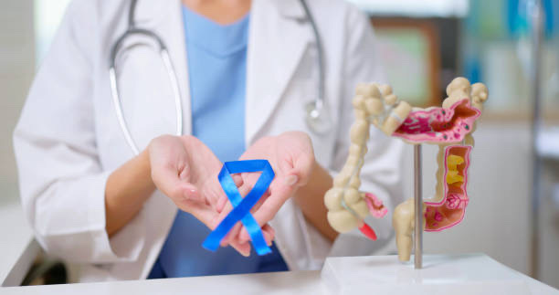 Colorectal Cancer
